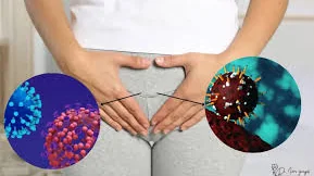 Genital Enfeksiyonlar ve Vajinit