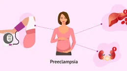 Preeklampsi ve Gebelikte Tansiyon